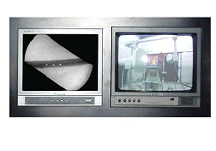 X-ray Computer Real Time Radiography System